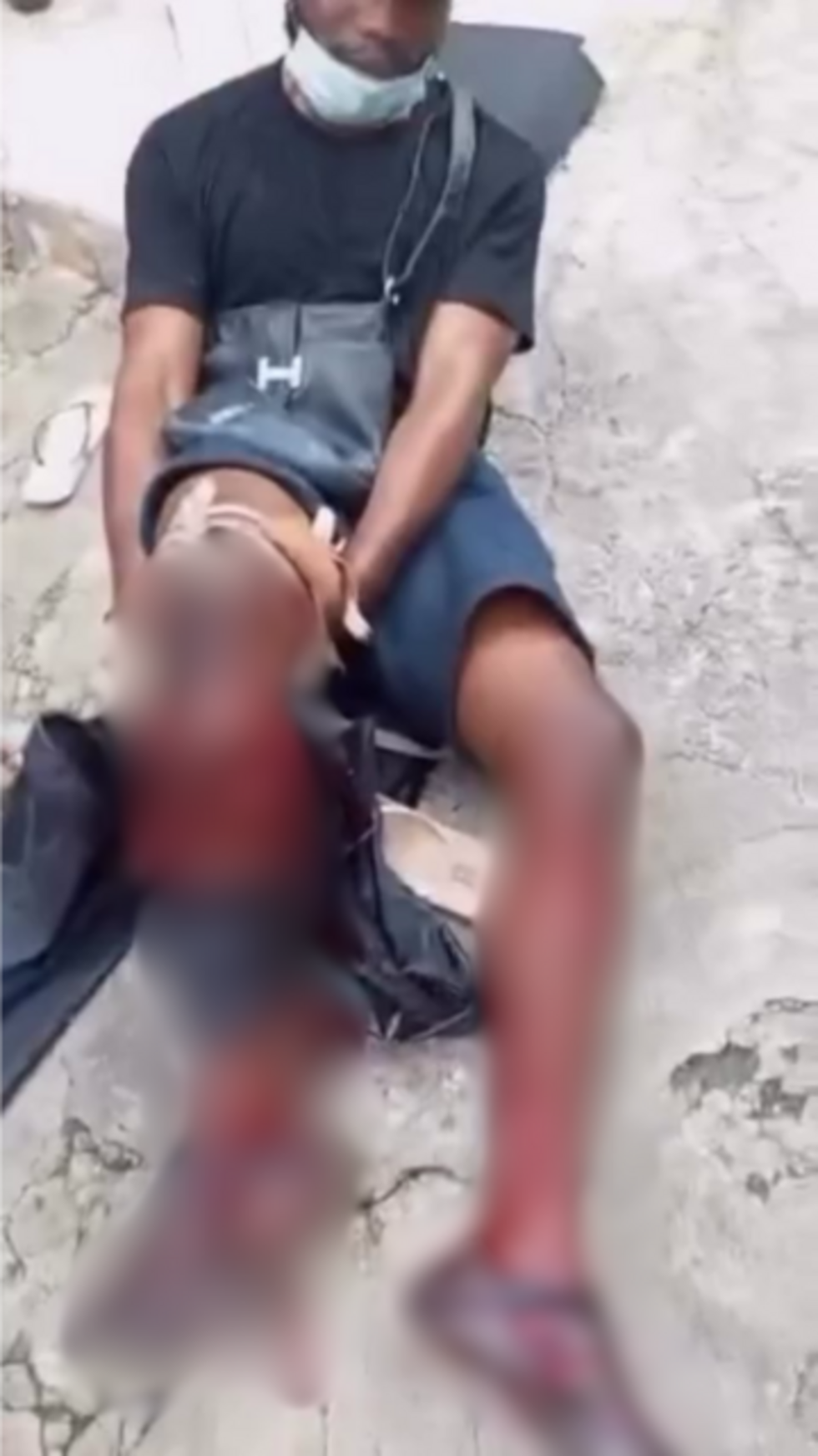 In the video from which this image is taken (which we have chosen not to show due to its graphic nature), a man with a severe calf wound can be seen receiving makeshift medical treatment.